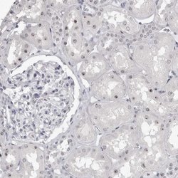 Invitrogen DDX54 Polyclonal Antibody 100 &mu;L; Unconjugated:Antibodies,