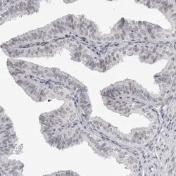 Invitrogen DDX54 Polyclonal Antibody 100 &mu;L; Unconjugated:Antibodies,