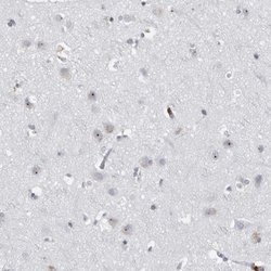 Invitrogen DDX54 Polyclonal Antibody 100 &mu;L; Unconjugated:Antibodies,