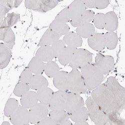 Invitrogen DDX54 Polyclonal Antibody 100 &mu;L; Unconjugated:Antibodies,