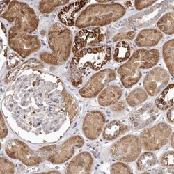 FMO2 Polyclonal Antibody, Invitrogen 100 &mu;L; Unconjugated:Anticuerpos