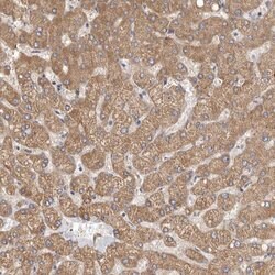 FMO2 Polyclonal Antibody, Invitrogen 100 &mu;L; Unconjugated:Anticuerpos