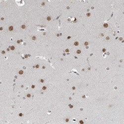 Invitrogen C8orf58 Polyclonal Antibody 100 &mu;L; Unconjugated:Antibodies,