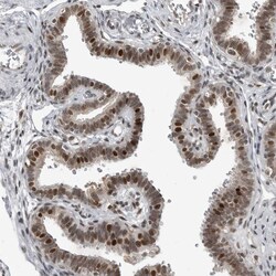 Invitrogen C8orf58 Polyclonal Antibody 100 &mu;L; Unconjugated:Antibodies,