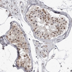 Invitrogen C8orf58 Polyclonal Antibody 100 &mu;L; Unconjugated:Antibodies,