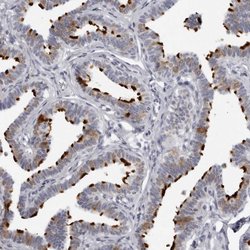 Invitrogen DNALI1 Polyclonal Antibody 100 &mu;L; Unconjugated:Antibodies,