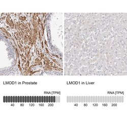 Invitrogen LMOD1 Polyclonal Antibody 100 &mu;L; Unconjugated:Antibodies,