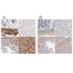 Invitrogen LMOD1 Polyclonal Antibody 100 &mu;L; Unconjugated:Antibodies,