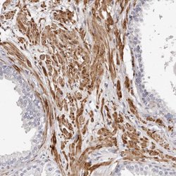 Invitrogen LMOD1 Polyclonal Antibody 100 &mu;L; Unconjugated:Antibodies,