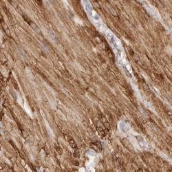 Invitrogen LMOD1 Polyclonal Antibody 100 &mu;L; Unconjugated:Antibodies,