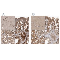 Invitrogen CEP350 Polyclonal Antibody 100 &mu;L; Unconjugated:Antibodies,