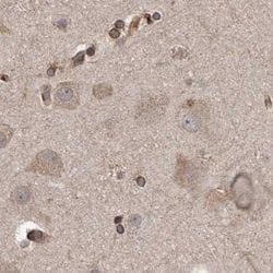 Invitrogen CEP350 Polyclonal Antibody 100 &mu;L; Unconjugated:Antibodies,