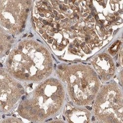 Invitrogen CEP350 Polyclonal Antibody 100 &mu;L; Unconjugated:Antibodies,