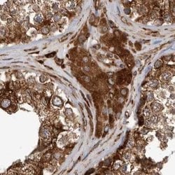 Invitrogen CEP350 Polyclonal Antibody 100 &mu;L; Unconjugated:Antibodies,