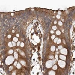 Invitrogen CEP350 Polyclonal Antibody 100 &mu;L; Unconjugated:Antibodies,