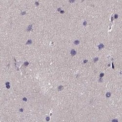 Invitrogen PAH Polyclonal Antibody 100 &mu;L; Unconjugated:Antibodies,
