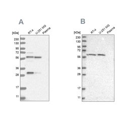Invitrogen PAH Polyclonal Antibody 100 &mu;L; Unconjugated:Antibodies,