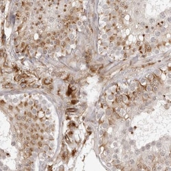 Invitrogen TCTEX1D1 Polyclonal Antibody 100 &mu;L; Unconjugated:Antibodies,