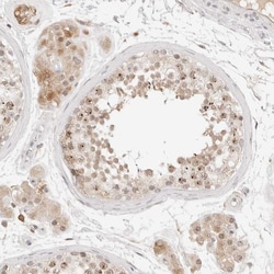 Invitrogen C17orf47 Polyclonal Antibody 100 &mu;L; Unconjugated:Antibodies,