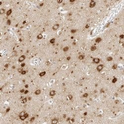 Invitrogen C1orf102 Polyclonal Antibody 100 &mu;L; Unconjugated:Antibodies,