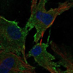 Invitrogen ADAMTS2 Polyclonal Antibody 100 &mu;L; Unconjugated:Antibodies,