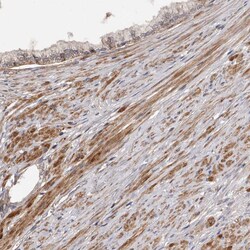 Invitrogen ADAMTS2 Polyclonal Antibody 100 &mu;L; Unconjugated:Antibodies,