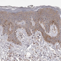 Invitrogen ADAMTS2 Polyclonal Antibody 100 &mu;L; Unconjugated:Antibodies,