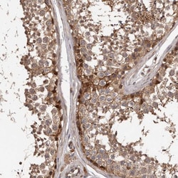 Invitrogen ADAMTS2 Polyclonal Antibody 100 &mu;L; Unconjugated:Antibodies,