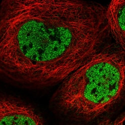 Invitrogen RSG1 Polyclonal Antibody 100 &mu;L; Unconjugated:Antibodies,