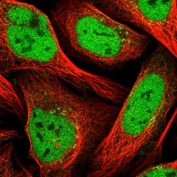 Invitrogen ZNF326 Polyclonal Antibody 100 &mu;L; Unconjugated:Antibodies,
