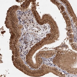 Invitrogen ZNF326 Polyclonal Antibody 100 &mu;L; Unconjugated:Antibodies,