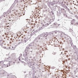 Invitrogen FAM71A Polyclonal Antibody 100 &mu;L; Unconjugated:Antibodies,