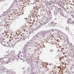 Invitrogen FAM71A Polyclonal Antibody 100 &mu;L; Unconjugated:Antibodies,