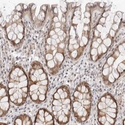 Invitrogen ITGB3BP Polyclonal Antibody 100 &mu;L; Unconjugated:Antibodies,