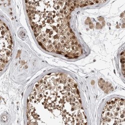 Invitrogen HENMT1 Polyclonal Antibody 100 &mu;L; Unconjugated:Antibodies,