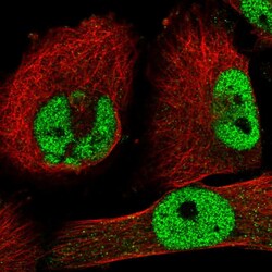 Invitrogen ZNF326 Polyclonal Antibody 100 &mu;L; Unconjugated:Antibodies,
