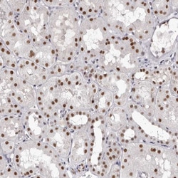 Invitrogen ZNF326 Polyclonal Antibody 100 &mu;L; Unconjugated:Antibodies,
