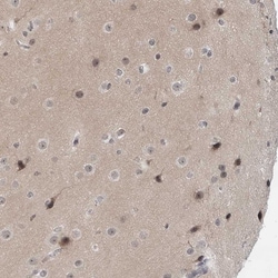 Invitrogen EXOSC10 Polyclonal Antibody 100 &mu;L; Unconjugated:Antibodies,