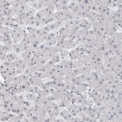 Invitrogen EXOSC10 Polyclonal Antibody 100 &mu;L; Unconjugated:Antibodies,