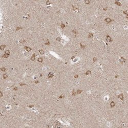 Invitrogen NENF Polyclonal Antibody 100 μL; Unconjugated:Antibodies,