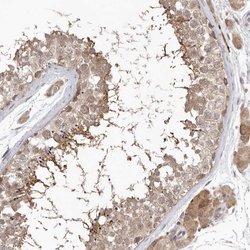 Invitrogen NSUN4 Polyclonal Antibody 100 &mu;L; Unconjugated:Antibodies,