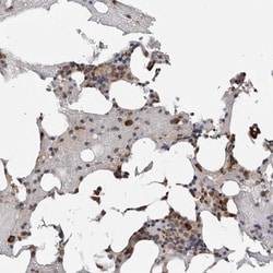 Invitrogen TRMT13 Polyclonal Antibody 100 &mu;L; Unconjugated:Antibodies,