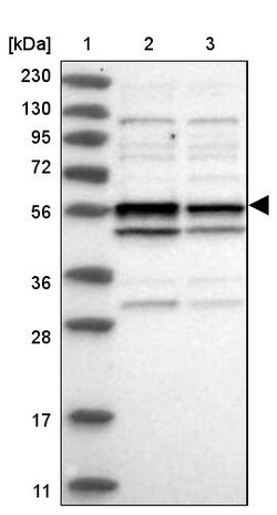 Invitrogen TRMT13 Polyclonal Antibody 100 &mu;L; Unconjugated:Antibodies,