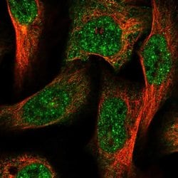 Invitrogen AGL Polyclonal Antibody 100 &mu;L; Unconjugated:Antibodies,
