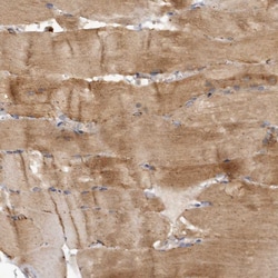 Invitrogen AGL Polyclonal Antibody 100 &mu;L; Unconjugated:Antibodies,