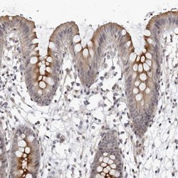 Invitrogen SERTAD4 Polyclonal Antibody 100 &mu;L; Unconjugated:Antibodies,