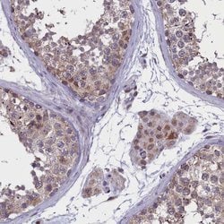 Invitrogen PARS2 Polyclonal Antibody 100 &mu;L; Unconjugated:Antibodies,