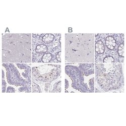 Invitrogen KIAA1751 Polyclonal Antibody 100 &mu;L; Unconjugated:Antibodies,