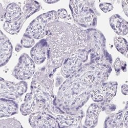 Invitrogen KIAA1751 Polyclonal Antibody 100 &mu;L; Unconjugated:Antibodies,