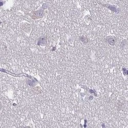 Invitrogen KIAA1751 Polyclonal Antibody 100 &mu;L; Unconjugated:Antibodies,